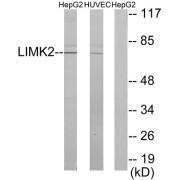 Western blot analysis of extracts from HepG2 cells and HUVEC cells, using LIMK2 antibody.