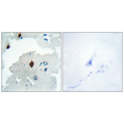 Pituitary Tumor-Transforming Gene 1 Protein-Interacting Protein (PTTG) Antibody