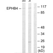 Western blot analysis of extracts from 293 cells and Jurkat cells, using EPHB4 antibody.