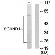 Western blot analysis of extracts from Jurkat cells, using SCAND1 antibody.