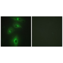 Transmembrane Protease, Serine 3 (TMPRSS3) Antibody
