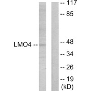 Western blot analysis of extracts from 293 cells, using LMO4 antibody.