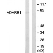 Western blot analysis of extracts from HepG2 cells, using ADARB1 antibody.