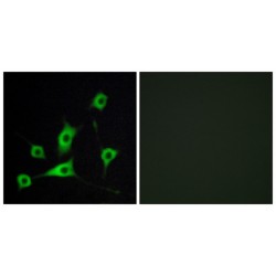 Cellular Retinol-Binding Protein III (CRBP III) Antibody