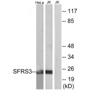 Western blot analysis of extracts from HeLa cells and Jurkat cells, using SFRS3 antibody.