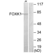 Western blot analysis of extracts from Jurkat cells, using FOXK1 antibody.