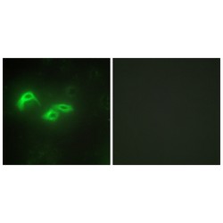 Transcription Factor A, Mitochondrial (TFAM) Antibody