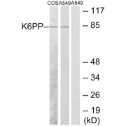 Western blot analysis of extracts from COS-7 cells and A549 cells, using K6PP antibody.