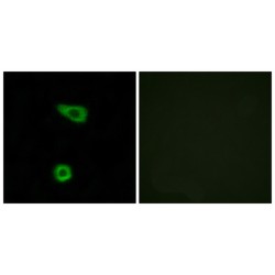 Tumor Necrosis Factor Alpha-Induced Protein 2 (TNAP2) Antibody