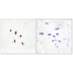 Mevalonate Kinase (MVK) Antibody