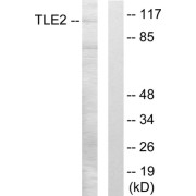 Western blot analysis of extracts from LOVO cells, using TLE2 antibody.