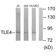 Western blot analysis of extracts from Jurkat cells, 293 cells and HuvEc cells, using TLE4 antibody.