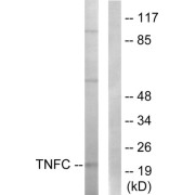 Western blot analysis of extracts from HepG2 cells, using TNFC antibody.
