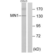 Western blot analysis of extracts from COLO cells, using MN1 antibody.