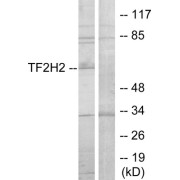 Western blot analysis of extracts from COLO205 cells, using TF2H2 antibody.