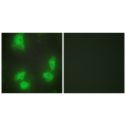 Cyclin Dependent Kinase 5 Activator 1 (CDK5R1) Antibody