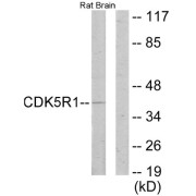 Western blot analysis of extracts from rat brain cells, using CDK5R1 antibody.