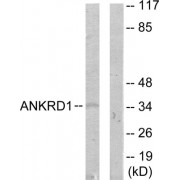 Western blot analysis of extracts from COLO205 cells, using ANKRD1 antibody.