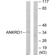 Western blot analysis of extracts from COLO205 cells, using ANKRD1 antibody.