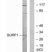 Western blot analysis of extracts from Jurkat cells, using SURF1 antibody.