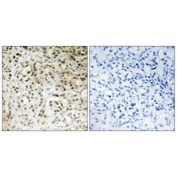 TATA-Box Binding Protein Associated Factor 5 (TAF5) Antibody
