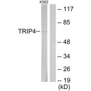Western blot analysis of extracts from K562 cells, using TRIP4 antibody.