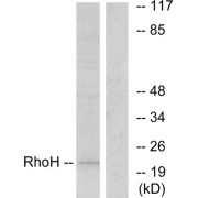Western blot analysis of extracts from HT-29 cells, using RHOH antibody.