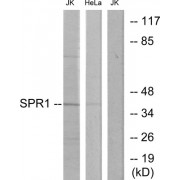 Western blot analysis of extracts from Jurkat cells and HeLa cells, using SPR1 antibody.