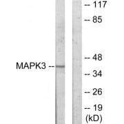 Western blot analysis of extracts from COLO205 cells, using MAPK3 antibody.