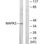 Western blot analysis of extracts from COLO205 cells, using MAPK3 antibody.