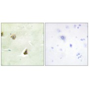 Immunohistochemistry analysis of paraffin-embedded human brain tissue, using DUSP6 antibody. The picture on the right is blocked with the synthesized peptide.