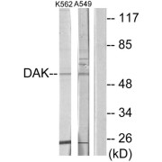Western blot analysis of extracts from K562 cells and A549 cells, using DAK antibody.