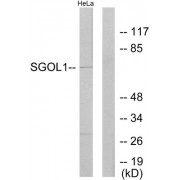 Western blot analysis of extracts from HeLa cells, using SGO1 antibody.