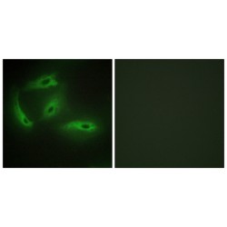 Cyclin Dependent Kinase Like 4 (CDKL4) Antibody