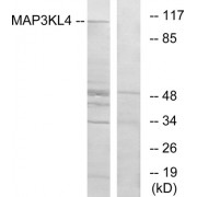 Western blot analysis of extracts from HT-29 cells, using MAP3KL4 antibody.