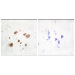 CaMK1 beta Antibody