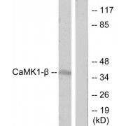 Western blot analysis of extracts from LOVO cells, treated with H2O2 (100uM, 30mins), using CaMK1-beta antibody.