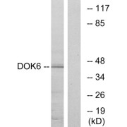Western blot analysis of extracts from COLO cells, using DOK6 antibody.