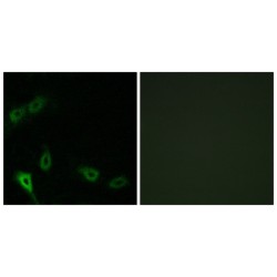 Serine/Threonine-Protein Kinase MARK2 (MARK2) Antibody