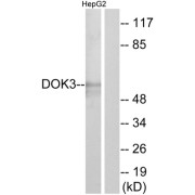 Western blot analysis of extracts from HepG2 cells, using DOK3 antibody.