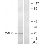 Western blot analysis of extracts from HT-29 cells, using MAGI2 antibody.
