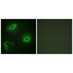 Putative BPIFA4P Protein (BPIFA4P) Antibody