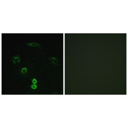 Glycerate Kinase (GLCTK) Antibody