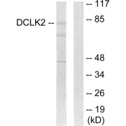 Western blot analysis of extracts from HepG2 cells, using DCLK2 antibody.