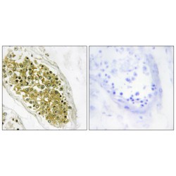 Homeodomain-Interacting Protein Kinase 4 (HIPK4) Antibody