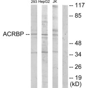 Western blot analysis of extracts from 293 cells, HepG2 cells and Jurkat cells, using ACRBP antibody.