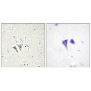 Immunohistochemistry analysis of paraffin-embedded human brain tissue, using ACTR1C antibody.