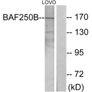 Western blot analysis of extracts from LOVO cells, using BAF250B antibody.