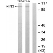 Western blot analysis of extracts from HUVEC cells and K562 cells, using RIN3 antibody.