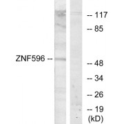 Western blot analysis of extracts from Jurkat cells, using ZNF596 antibody.